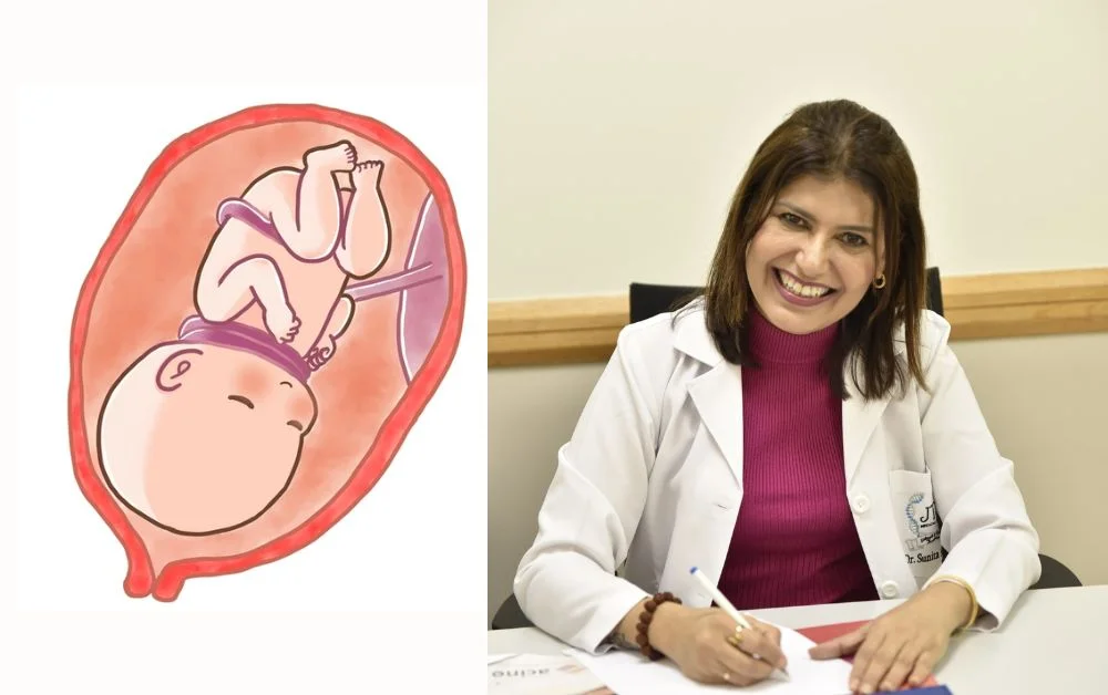 Understanding the Implications of Cord Around the Fetal Neck
