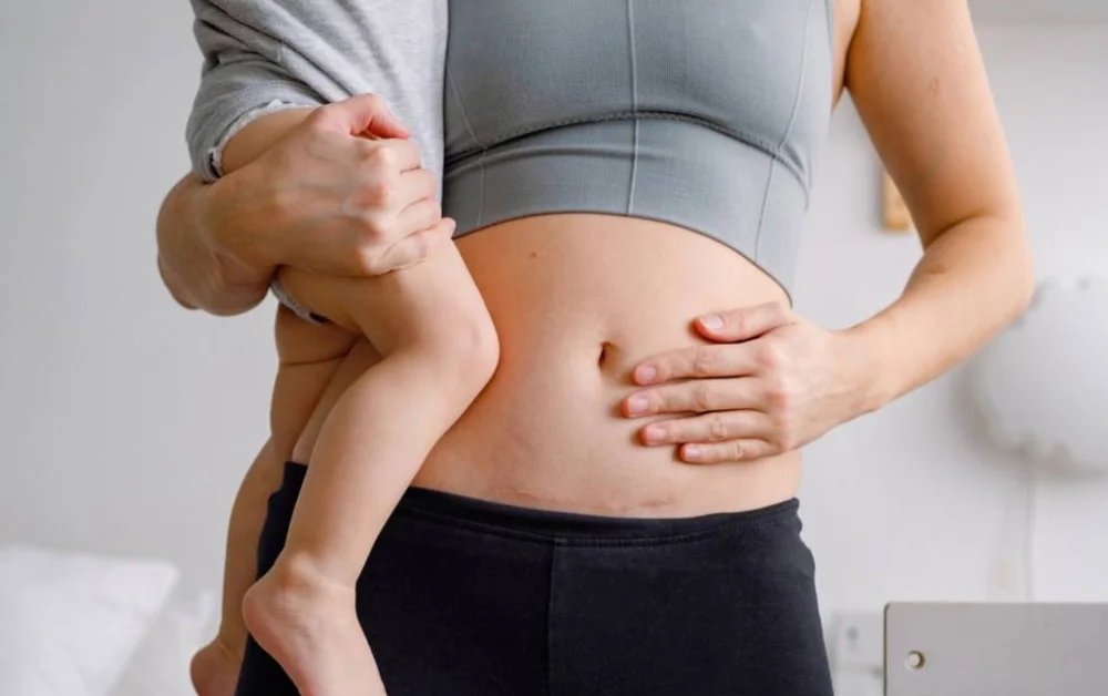 Top Hospitals Offering Affordable C-Section Delivery Packages